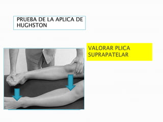 PRUEBA DE LA APLICA DE
  HUGHSTON




Prueba de la plica de
Hughston
 