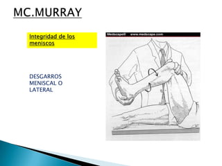 Integridad de los
meniscos




DESGARROS
MENISCAL O
LATERAL
 