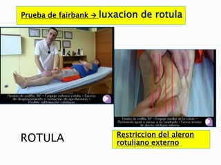 Prueba de fairbank  luxacion   de rotula




                       Restriccion del aleron
ROTULA                 rotulia...