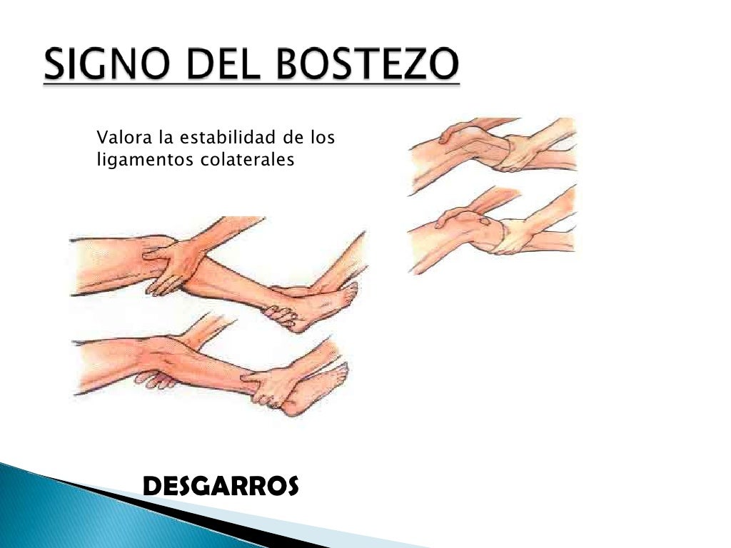 Semiologia de rodilla
