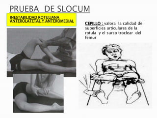 INESTABILIDAD ROTULIANA
ANTEROLATETAL Y ANTEROMEDIAL
                               CEPILLO : valora la calidad de
                               superficies articulares de la
                               rotula y el surco troclear del
                               femur
 