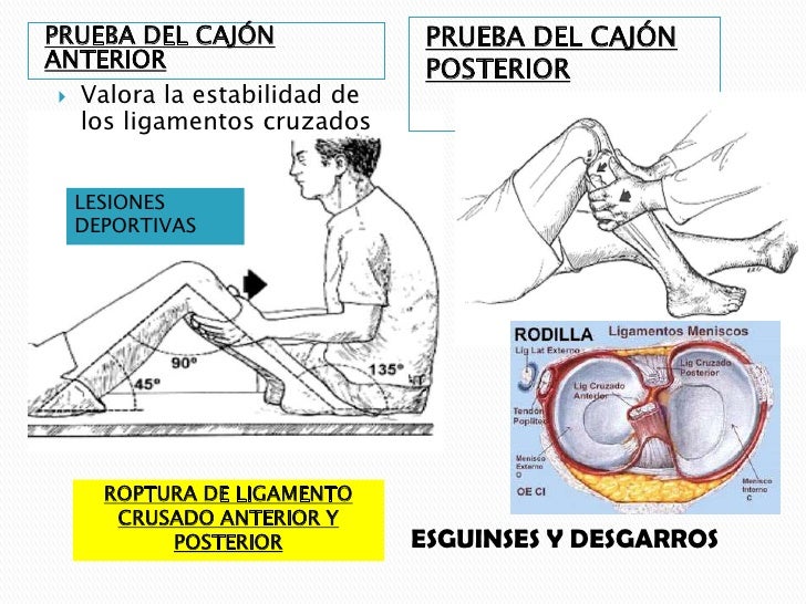 Semiologia de rodilla ORTOPEDIA 1