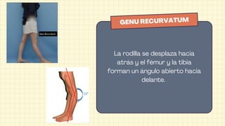 Semiología de rodilla, diagnóstico y tratamiento | PDF