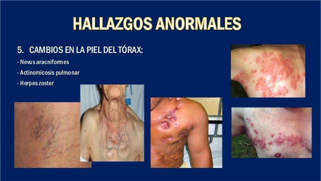 Un curso corto en como saber si tienes hipertensión
