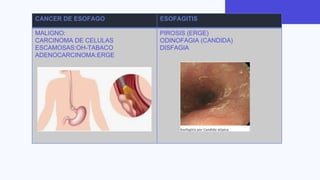 semiologia digestiva.pdf