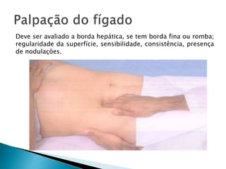 Deve ser avaliado a borda hepática, se tem borda fina ou romba;
regularidade da superfície, sensibilidade, consistência, presença
de nodulações.
 