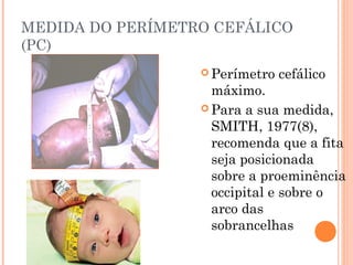 MEDIDA DO PERÍMETRO CEFÁLICO
(PC)
 Perímetro cefálico
máximo.
 Para a sua medida,
SMITH, 1977(8),
recomenda que a fita
seja posicionada
sobre a proeminência
occipital e sobre o
arco das
sobrancelhas
 