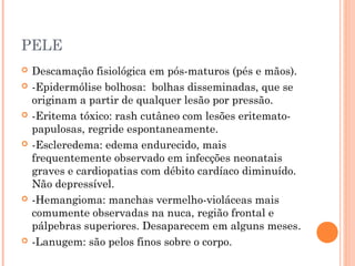 PELE
 Descamação fisiológica em pós-maturos (pés e mãos).
 -Epidermólise bolhosa: bolhas disseminadas, que se
originam a partir de qualquer lesão por pressão.
 -Eritema tóxico: rash cutâneo com lesões eritemato-
papulosas, regride espontaneamente.
 -Escleredema: edema endurecido, mais
frequentemente observado em infecções neonatais
graves e cardiopatias com débito cardíaco diminuído.
Não depressível.
 -Hemangioma: manchas vermelho-violáceas mais
comumente observadas na nuca, região frontal e
pálpebras superiores. Desaparecem em alguns meses.
 -Lanugem: são pelos finos sobre o corpo.
 