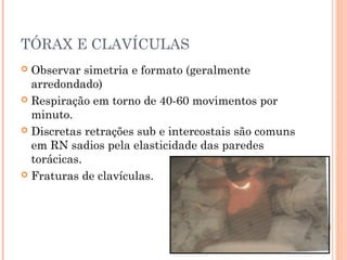 TÓRAX E CLAVÍCULAS
 Observar simetria e formato (geralmente
arredondado)
 Respiração em torno de 40-60 movimentos por
minuto.
 Discretas retrações sub e intercostais são comuns
em RN sadios pela elasticidade das paredes
torácicas.
 Fraturas de clavículas.
 