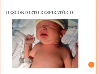 DESCONFORTO RESPIRATÓRIO
 
