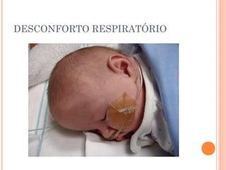 DESCONFORTO RESPIRATÓRIO
 
