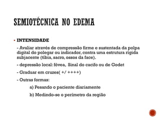 § INTENSIDADE
- Avaliar através de compressão firme e sustentada da polpa
digital do polegar ou indicador, contra uma estrutura rígida
subjacente (tíbia, sacro, ossos da face).
- depressão local: fóvea, Sinal do cacifo ou de Godet
- Graduar em cruzes( +/ ++++)
- Outras formas:
a) Pesando o paciente diariamente
b) Medindo-se o perímetro da região
 