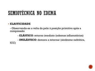 § ELASTICIDADE
- Observando-se a volta da pele à posição primitiva após a
compressão
- ELÁSTICO: retorno imediato (edemas inflamatórios)
- INELÁSTICO: demora a retornar (síndrome nefrótica,
ICC)
 