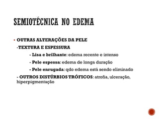 § OUTRAS ALTERAÇÕES DA PELE
-TEXTURA E ESPESSURA
- Lisa e brilhante: edema recente e intenso
- Pele espessa: edema de longa duração
- Pele enrugada: qdo edema está sendo eliminado
- OUTROS DISTÚRBIOS TRÓFICOS: atrofia, ulceração,
hiperpigmentação
 