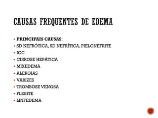 § PRINCIPAIS CAUSAS:
§ SD NEFRÓTICA, SD NEFRÍTICA, PIELONEFRITE
§ ICC
§ CIRROSE HEPÁTICA
§ MIXEDEMA
§ ALERGIAS
§ VARIZES
§ TROMBOSE VENOSA
§ FLEBITE
§ LINFEDEMA
 