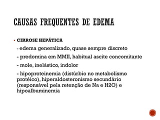 § CIRROSE HEPÁTICA
- edema generalizado, quase sempre discreto
- predomina em MMII, habitual ascite concomitante
- mole, inelástico, indolor
- hipoproteinemia (distúrbio no metabolismo
protéico), hiperaldosteronismo secundário
(responsável pela retenção de Na e H2O) e
hipoalbuminemia
 