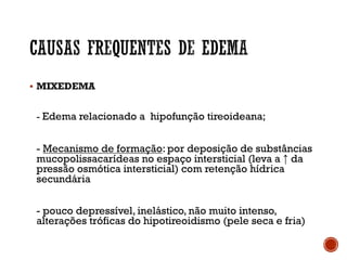§ MIXEDEMA
- Edema relacionado a hipofunção tireoideana;
- Mecanismo de formação: por deposição de substâncias
mucopolissacarídeas no espaço intersticial (leva a ↑ da
pressão osmótica intersticial) com retenção hídrica
secundária
- pouco depressível, inelástico, não muito intenso,
alterações tróficas do hipotireoidismo (pele seca e fria)
 