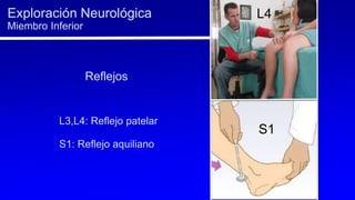 L3,L4: Reflejo patelar
S1: Reflejo aquiliano
Exploración Neurológica
Miembro Inferior
Reflejos
L4
S1
 