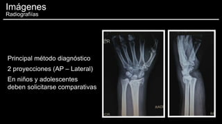 Principal método diagnóstico
2 proyecciones (AP – Lateral)
En niños y adolescentes
deben solicitarse comparativas
Imágenes
Radiografiías
 
