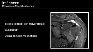 Tejidos blandos con mayor detalle
Multiplanar
Utiliza campos magnéticos
Imágenes
Resonancia Magnética Nuclear
 