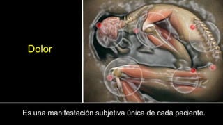 Es una manifestación subjetiva única de cada paciente.
Dolor
 