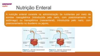 Nutrição Enteral
A nutrição enteral consiste na administração de nutrientes por meio de
sondas nasogástrica (introduzida pelo nariz, com posicionamento no
estômago) ou transpilórica (nasoenteral), introduzida pelo nariz, com
posicionamento no duodeno ou jejuno,
 