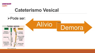 Cateterismo Vesical
Alívio
Demora
Pode ser:
Fonte: Facebook.com
 