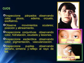 OJOS
Inspeccione párpados observando
color, ptosis, edema, orzuelo,
exoftalmio.
Observe movimientos oculares;
posición y alineamiento.
Inspeccione conjuntivas observando
color, hidratación, exudado y lesiones.
Inspeccione esclerótica observando
color, pigmentación, vascularización.
Inspeccione pupilas observando
tamaño, simetría y reflejo al rayo de
luz.
EXOFTALMIA
PTOSIS
 