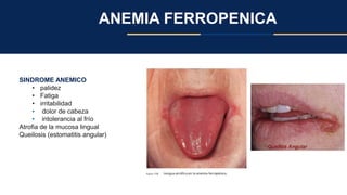 ANEMIA FERROPENICA
SINDROME ANEMICO
• palidez
• Fatiga
• irritabilidad
• dolor de cabeza
• intolerancia al frío
Atrofia de la mucosa lingual
Queilosis (estomatitis angular)
 