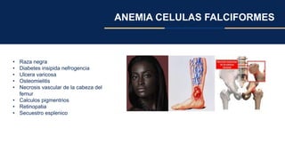 ANEMIA CELULAS FALCIFORMES
• Raza negra
• Diabetes insipida nefrogencia
• Ulcera varicosa
• Osteomielitis
• Necrosis vascular de la cabeza del
femur
• Calculos pigmentrios
• Retinopatia
• Secuestro esplenico
 