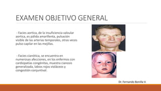 EXAMEN OBJETIVO GENERAL
- Facies aortica, de la insuficiencia valvular
aortica, es pálida amarillenta, pulsación
visible de las arterias temporales, otras veces
pulso capilar en las mejillas.
- Facies cianótica, se encuentra en
numerosas afecciones, en los enfermos con
cardiopatías congénitas, muestra cianosis
generalizada, labios rojos violáceos y
congestión conjuntival.
Dr. Fernando Bonilla V.
 