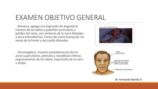 EXAMEN OBJETIVO GENERAL
- Disneica, agrega a la expresión de angustia la
cianosis de los labios y pabellón auriculares y
palidez del resto, con ventanas de la nariz dilatadas
y boca entreabiertas. Facies del asma bronquial, las
venas de la frente y del cuello dilatadas.
- Acromegálica, muestra protuberancias de los
arcos superciliares, pómulos y mandíbula inferior,
engrosamiento de los labios, hipertrofia de la nariz
y orejas.
Dr. Fernando Bonilla V.
 