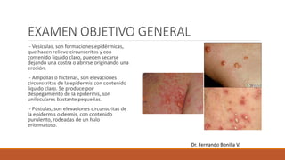 EXAMEN OBJETIVO GENERAL
- Vesículas, son formaciones epidérmicas,
que hacen relieve circunscritos y con
contenido liquido claro, pueden secarse
dejando una costra o abrirse originando una
erosión.
- Ampollas o flictenas, son elevaciones
circunscritas de la epidermis con contenido
liquido claro. Se produce por
despegamiento de la epidermis, son
uniloculares bastante pequeñas.
- Pústulas, son elevaciones circunscritas de
la epidermis o dermis, con contenido
purulento, rodeadas de un halo
eritematoso.
Dr. Fernando Bonilla V.
 