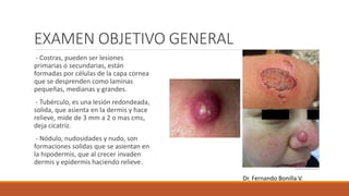 EXAMEN OBJETIVO GENERAL
- Costras, pueden ser lesiones
primarias o secundarias, están
formadas por células de la capa cornea
que se desprenden como laminas
pequeñas, medianas y grandes.
- Tubérculo, es una lesión redondeada,
solida, que asienta en la dermis y hace
relieve, mide de 3 mm a 2 o mas cms,
deja cicatriz.
- Nódulo, nudosidades y nudo, son
formaciones solidas que se asientan en
la hipodermis, que al crecer invaden
dermis y epidermis haciendo relieve.
Dr. Fernando Bonilla V.
 