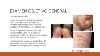 EXAMEN OBJETIVO GENERAL
Lesiones secundarias
- Costras, resultan de la desecación de
trasudados, exudados o sangre, es
característica la costra melicérica del
impétigo y la hemática en los epiteliomas.
- Fisuras o grietas, son soluciones de
continuidad lineales, sin perdida de
substancia. Pueden ser de origen traumático
en una piel elástica y disminuida.
- Excoriaciones, son pequeñas perdidas de
substancias de origen traumático, limitadas
a la epidermis y que curan sin dejar cicatriz.
Dr. Fernando Bonilla V.
 