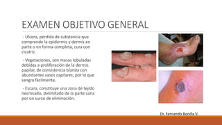 EXAMEN OBJETIVO GENERAL
- Ulcera, perdida de substancia que
comprende la epidermis y dermis en
parte o en forma completa, cura con
cicatriz.
- Vegetaciones, son masas lobuladas
debidas a proliferación de la dermis
papilar, de consistencia blanda con
abundantes vasos capilares, por lo que
sangra fácilmente.
- Escara, constituye una zona de tejido
necrosado, delimitado de la parte sana
por un surco de eliminación.
Dr. Fernando Bonilla V.
 