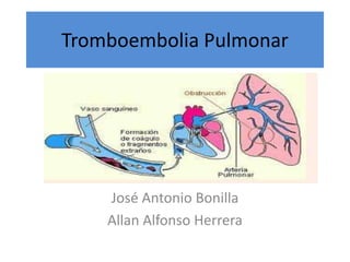 Tromboembolia Pulmonar

José Antonio Bonilla
Allan Alfonso Herrera

 
