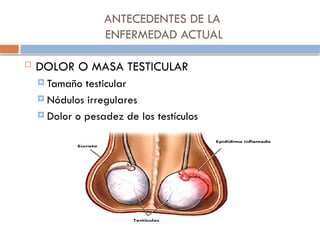 ANTECEDENTES DE LA
ENFERMEDAD ACTUAL
 DOLOR O MASA TESTICULAR
 Tamaño testicular
 Nódulos irregulares
 Dolor o pesadez de los testículos
 