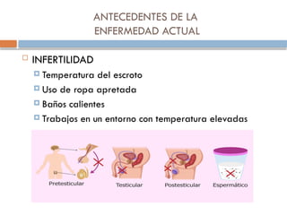 ANTECEDENTES DE LA
ENFERMEDAD ACTUAL
 INFERTILIDAD
 Temperatura del escroto
 Uso de ropa apretada
 Baños calientes
 Trabajos en un entorno con temperatura elevadas
 