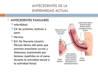 ANTECEDENTES DE LA
ENFERMEDAD ACTUAL
 ANTECEDENTES FAMILIARES
 Infertilidad
 CA de próstata, testículo o
pene
 Hernias
 Enf. De Peyronie (cicatriz
fibrosa dentro del pene que
provoca erecciones curvas y
dolorosas, ocacionada por
lesiones repetidas en el pene,
durante la actividad sexual o
la actividad física)
 