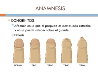ANAMNESIS
 CONGÉNITOS
 Afección en la que el prepucio es demasiado estrecho
y no se puede retraer sobre el glande.
 Fimosis
 