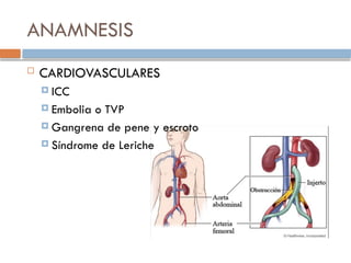 ANAMNESIS
 CARDIOVASCULARES
 ICC
 Embolia o TVP
 Gangrena de pene y escroto
 Síndrome de Leriche
 