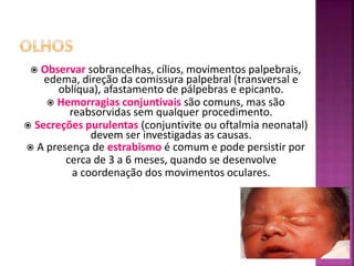 Observar sobrancelhas, cílios, movimentos palpebrais,
edema, direção da comissura palpebral (transversal e
oblíqua), afastamento de pálpebras e epicanto.
 Hemorragias conjuntivais são comuns, mas são
reabsorvidas sem qualquer procedimento.
 Secreções purulentas (conjuntivite ou oftalmia neonatal)
devem ser investigadas as causas.
 A presença de estrabismo é comum e pode persistir por
cerca de 3 a 6 meses, quando se desenvolve
a coordenação dos movimentos oculares.
 