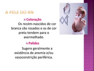 Coloração
Os recém-nascidos de cor
branca são rosados e os de cor
preta tendem para o
avermelhado.
 Palidez
Sugere geralmente a
existência de anemia e/ou
vasoconstrição periférica.
 