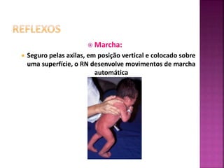  Marcha:
 Seguro pelas axilas, em posição vertical e colocado sobre
uma superfície, o RN desenvolve movimentos de marcha
automática
 