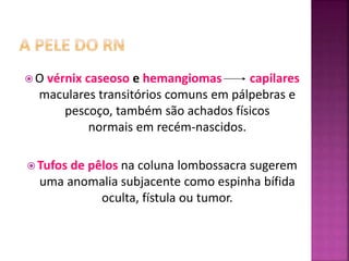  O vérnix caseoso e hemangiomas capilares
maculares transitórios comuns em pálpebras e
pescoço, também são achados físicos
normais em recém-nascidos.
 Tufos de pêlos na coluna lombossacra sugerem
uma anomalia subjacente como espinha bífida
oculta, fístula ou tumor.
 