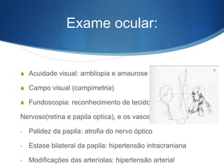 Exame ocular:


S Acuidade visual: ambliopia e amaurose

S Campo visual (campimetria)

S Fundoscopia: reconhecimento de tecido

Nervoso(retina e papila optica), e os vasos.

-   Palidez da papila: atrofia do nervo óptico

-   Estase bilateral da papila: hipertensão intracraniana

-   Modificações das arteríolas: hipertensão arterial
 