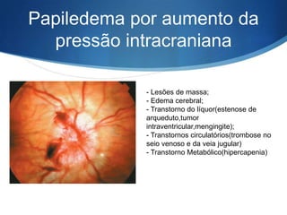 Papiledema por aumento da
  pressão intracraniana

            - Lesões de massa;
            - Edema cerebral;
            - Transtorno do líquor(estenose de
            arqueduto,tumor
            intraventricular,mengingite);
            - Transtornos circulatórios(trombose no
            seio venoso e da veia jugular)
            - Transtorno Metabólico(hipercapenia)
 