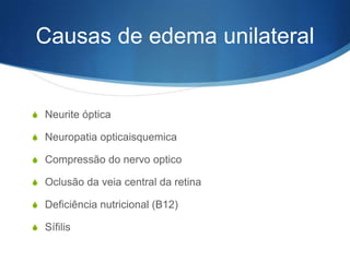 Causas de edema unilateral


S Neurite óptica

S Neuropatia opticaisquemica

S Compressão do nervo optico

S Oclusão da veia central da retina

S Deficiência nutricional (B12)

S Sífilis
 