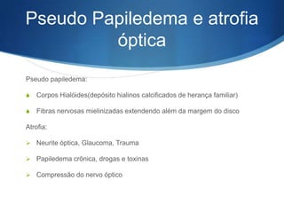 Pseudo Papiledema e atrofia
         óptica
Pseudo papiledema:

S   Corpos Hialóides(depósito hialinos calcificados de herança familiar)

S   Fibras nervosas mielinizadas extendendo além da margem do disco

Atrofia:

 Neurite óptica, Glaucoma, Trauma

 Papiledema crônica, drogas e toxinas

 Compressão do nervo óptico
 
